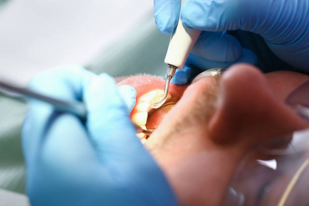 Emergency Gum Pain Relief in OK