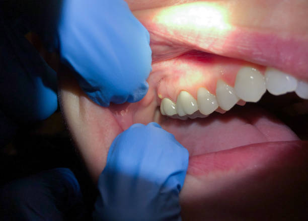 Best Tooth Pain Emergency Relief  in Fort Gibson, OK