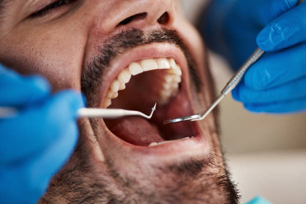 Tooth Infection Emergency Dentist in OK