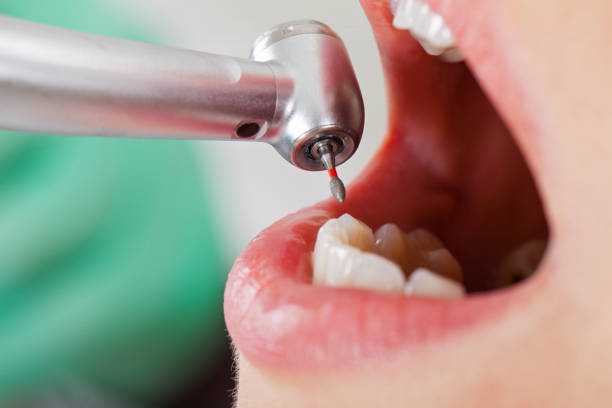 Best Teeth Whitening  in Fort Gibson, OK